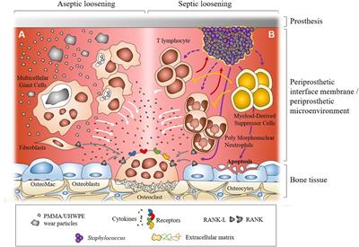 Interaction Between Staphylococcal Biofilm and Bone: How Does the Presence of Biofilm Promote Prosthesis Loosening?